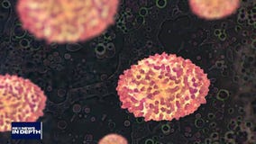 In Depth: Monkeypox, AI and Imaging, Medical Corps in Ukraine