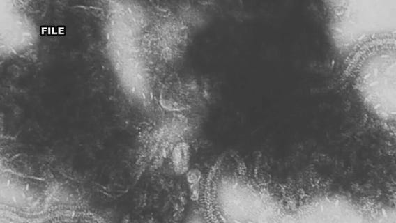 Child under age 4 dies from possible RSV case in Riverside County