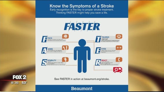 The Doctor Is In: Stroke in younger adults