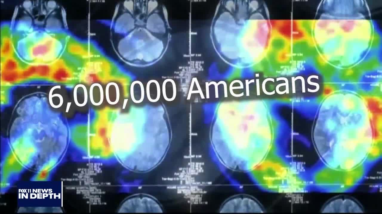 In Depth: Alzheimer's and Music