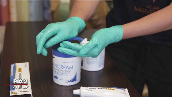 Eczema, food allergies and asthma in children all on the rise