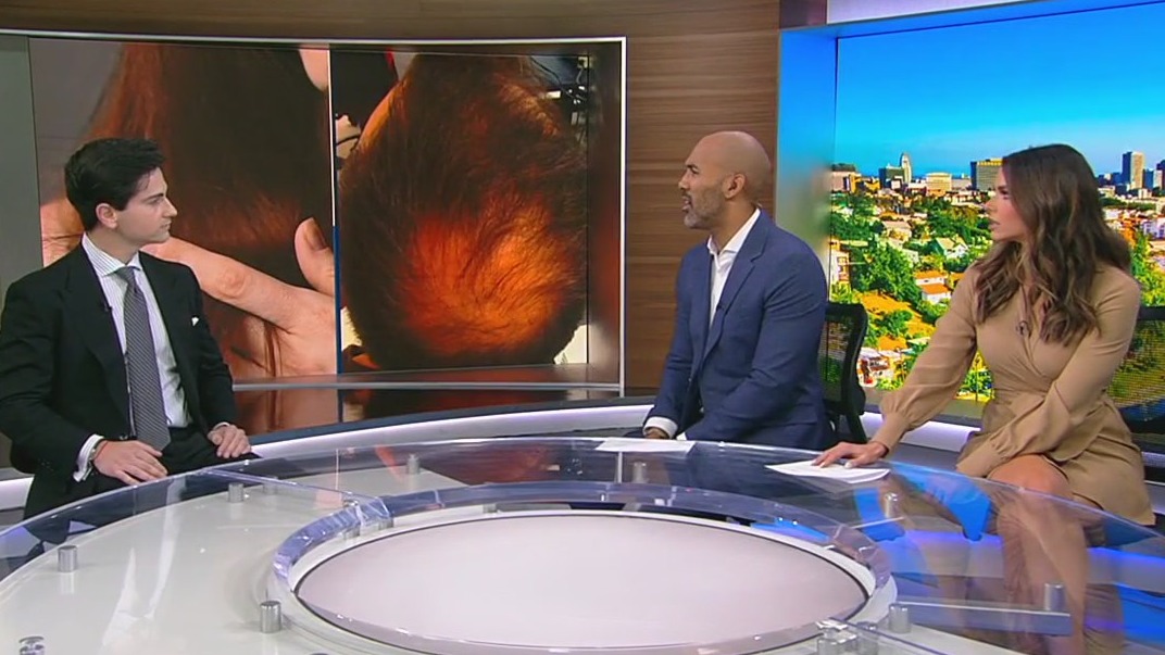 Hair loss treatments