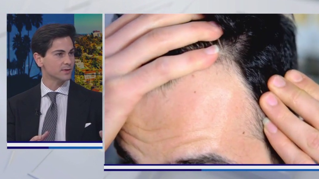 New approach to hair loss for men and women