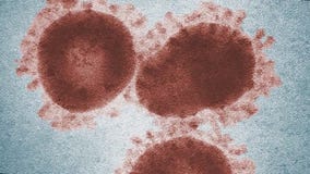 The Doctor Is In: Covid-19 Answering your Questions