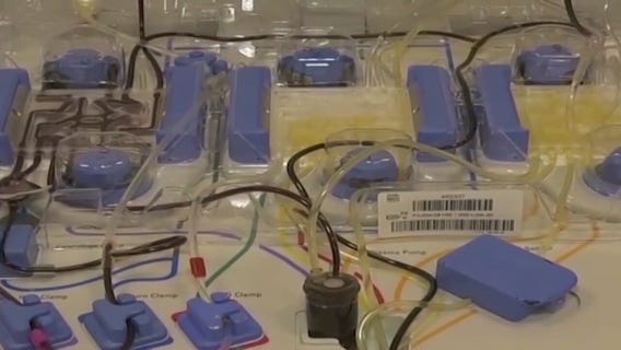 Plasma treatment for COVID-19 bringing new hope