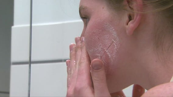 How to prevent mask-related acne