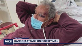 Elderly man suffers serious head injuries after random attack in Baldwin Park