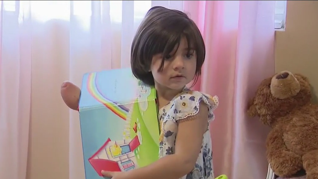 Limb Difference Awareness Month: Milla embracing her uniqueness with smile, energy