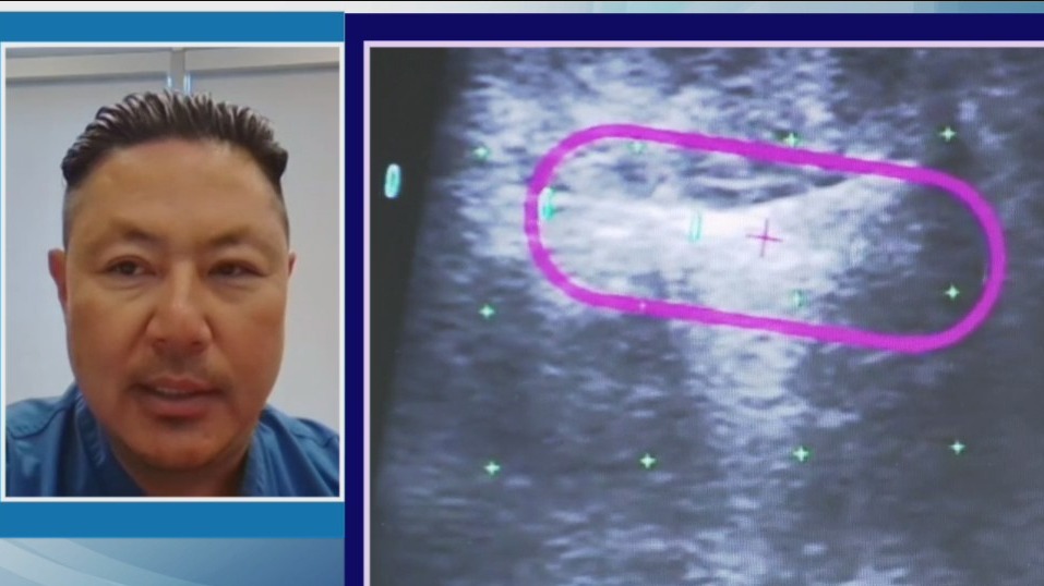 What every woman should know about uterine fibroids