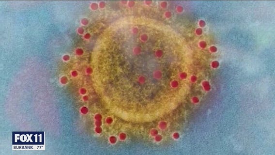 COVID-19 cases continues to surge across Southern California