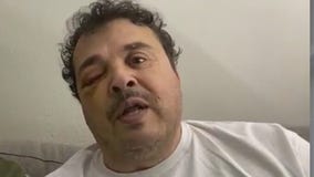 Lyft driver brutally beaten by passengers in San Bernardino, family says