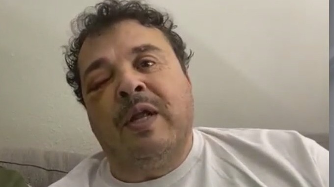 Lyft driver brutally beaten by passengers in San Bernardino, family says