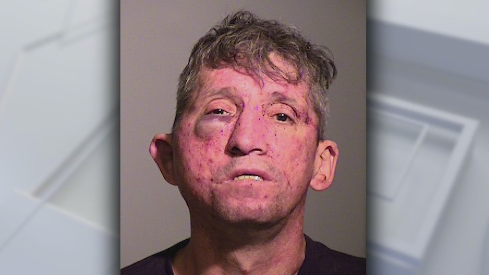 Suspected burglar gets beat up by homeowner in Ventura County before arrest