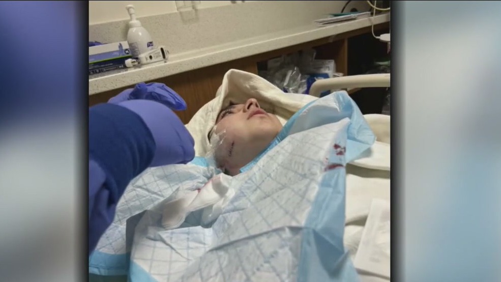 16-year-old Montclair girl stabbed multiple times