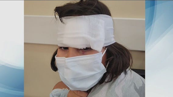 Girl injured on Six Flags Magic Mountain rollercoaster