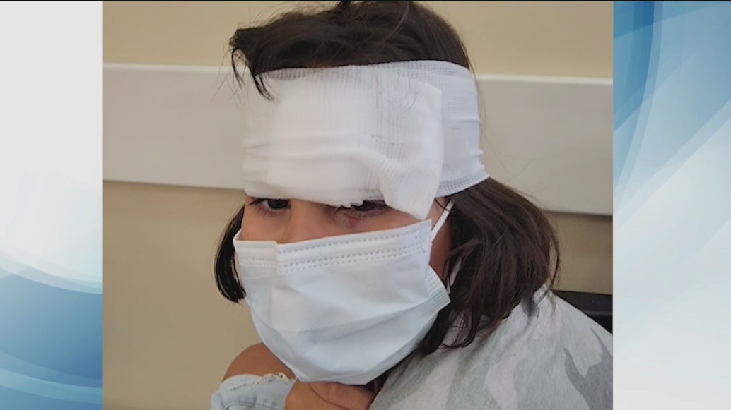 Girl injured on Six Flags Magic Mountain rollercoaster