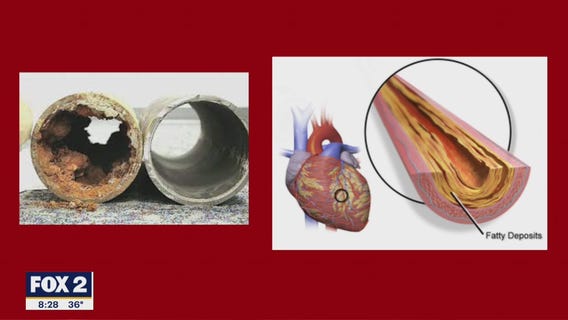 The Doctor Is In : Where to start with Heart Health?