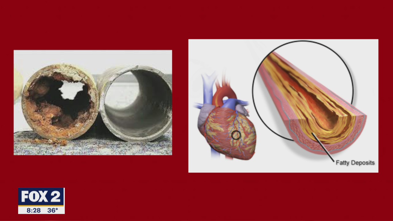 The Doctor Is In : Where to start with Heart Health?