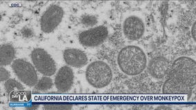 California declares State of Emergency over monkeypox