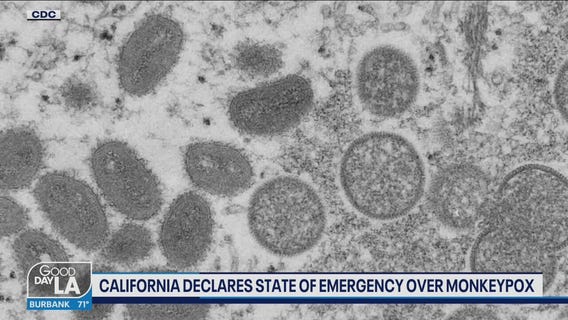 California declares State of Emergency over monkeypox
