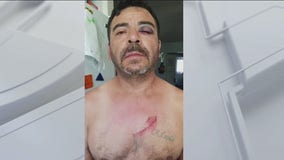Dad attacked by 3 robbers on his way home from work in South LA area
