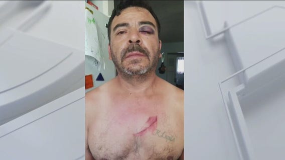 Dad attacked by 3 robbers on his way home from work in South LA area