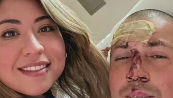 Family friend of LA County cadet injured in crash speaks out