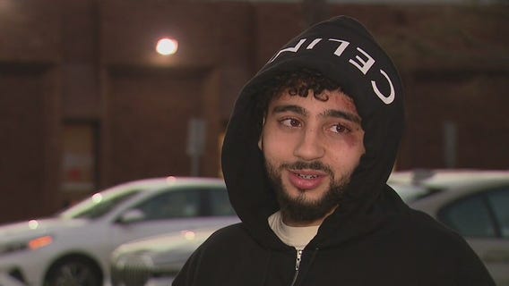 Social media influencer pistol-whipped, robbed by home invasion suspects