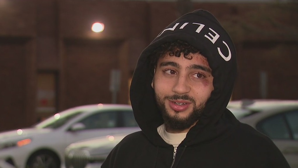 Social media influencer pistol-whipped, robbed by home invasion suspects