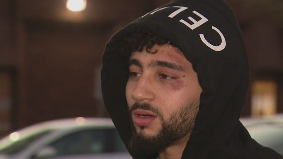 Social media influencer opens up about being attacked by armed robbers in Hollywood Hills