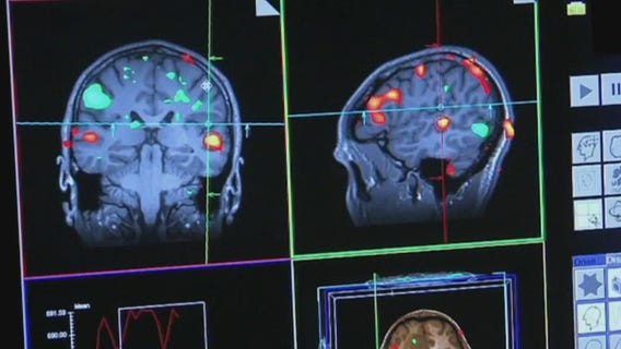 Long-term exposure to traffic pollution causes brain damage