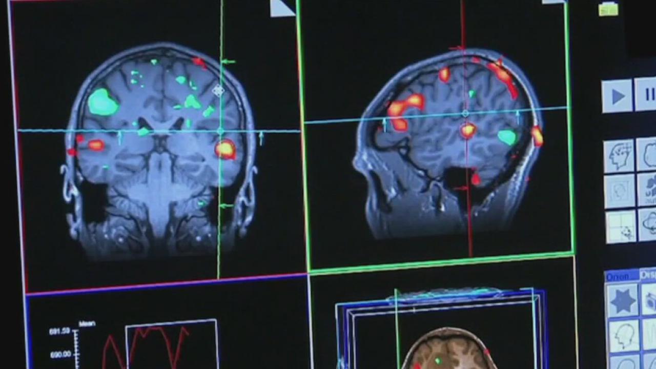 Long-term exposure to traffic pollution causes brain damage