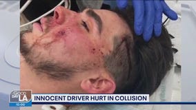 20-year-old bystander hit as OC police chase comes to an end