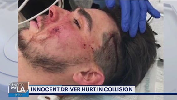 20-year-old bystander hit as OC police chase comes to an end