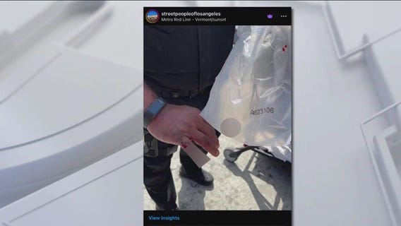 Homeless person allegedly bites off officer's finger