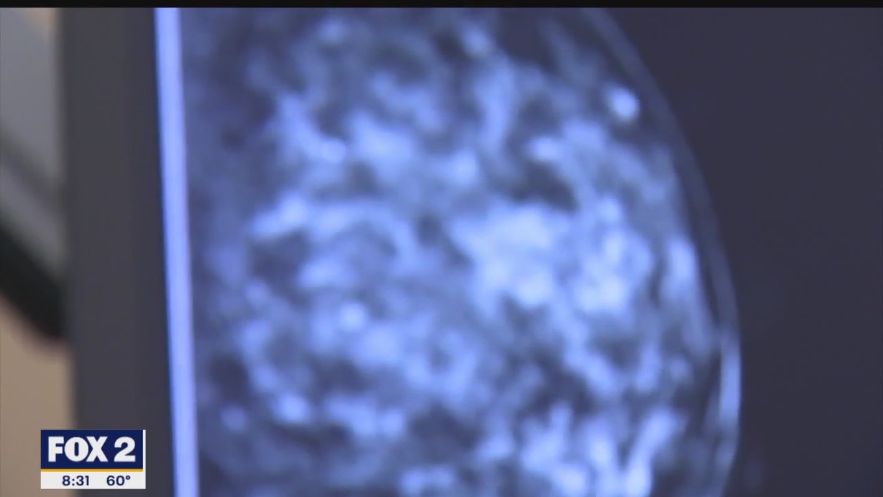 The Doctor Is In: Breast Cancer Screening and the Impact of Age