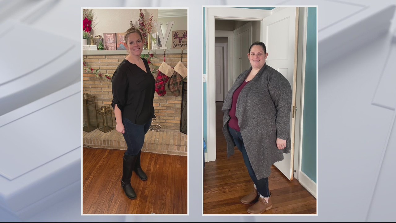 The Doctor's In: Shedding Light on Bariatric Surgery