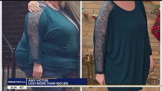 The Doctor Is In: Weight Loss Surgery