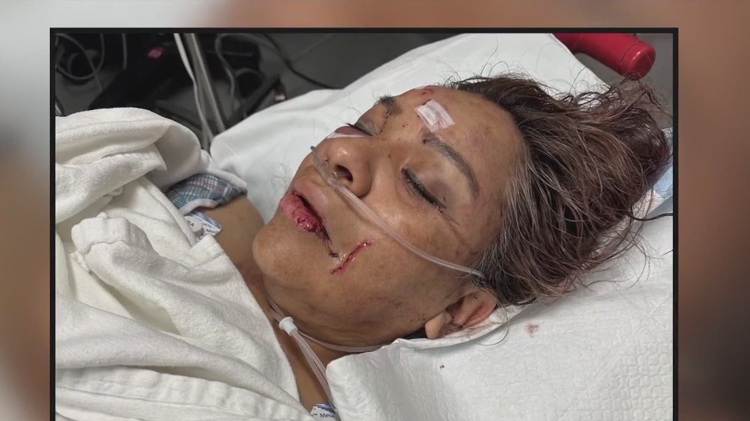 Woman beaten in front home while daughter screamed for help