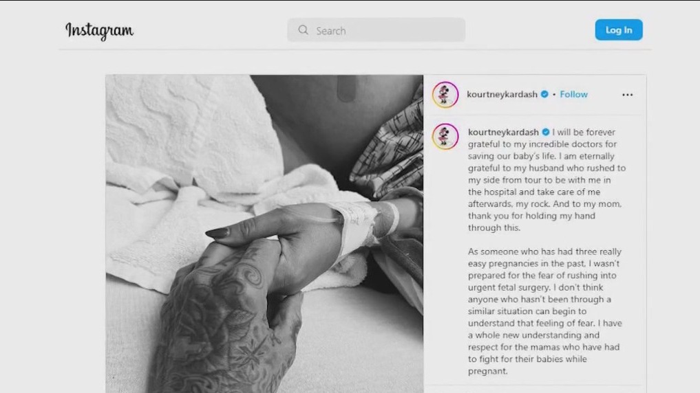 Kourtney Kardashian has surgery