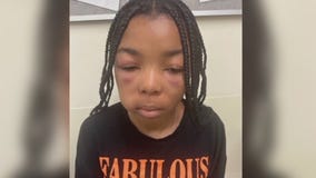 Teen girl attacked by adult at a McDonald's