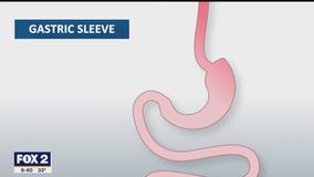 The Doctor Is In: Alex's Weight Loss Journey