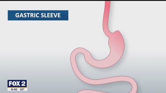 The Doctor Is In: Alex's Weight Loss Journey