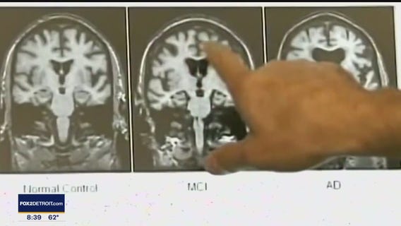 Weekend Symposium Offers Patients and Caregivers Insight on Coping with Parkinson's Disease