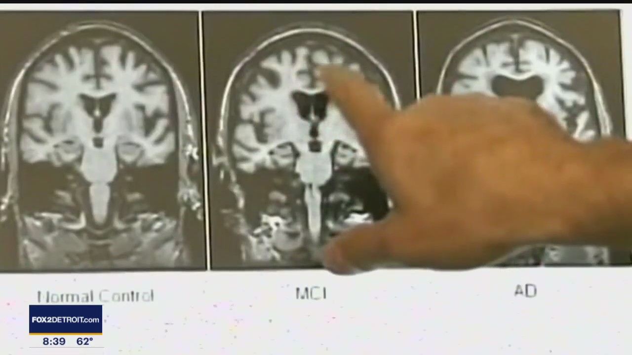 Weekend Symposium Offers Patients and Caregivers Insight on Coping with Parkinson's Disease