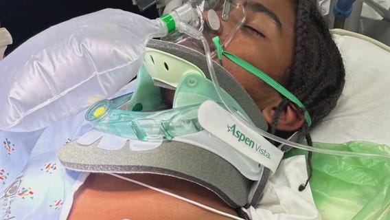 Teen attacked by other teens at Dockweiler