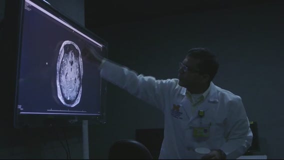 Tech lets doctors evaluate stroke symptoms virtually