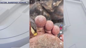 Barefoot shoes trending on TikTok