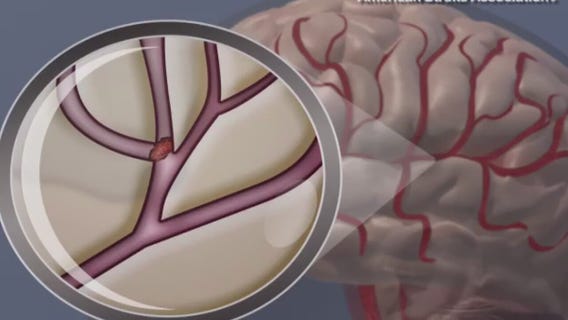 How to keep your cholesterol in check this summer