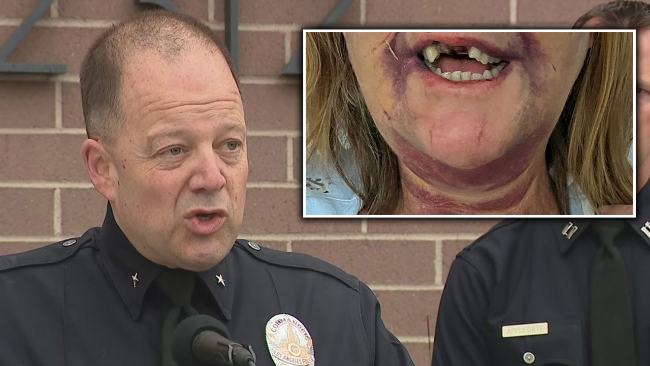 Suspect arrested in Venice Canals assaults